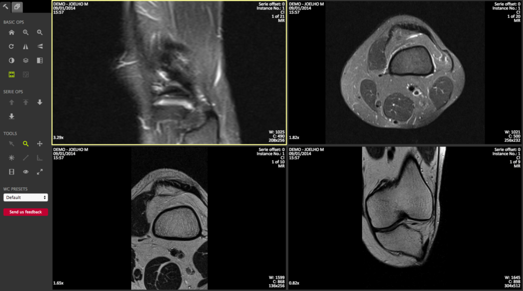 CT scan viewer online