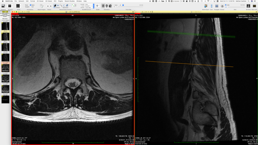 CT scan viewer online