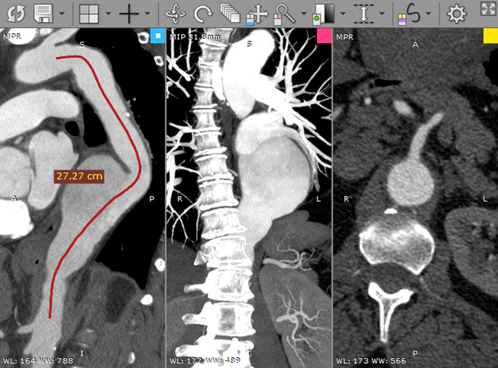 Android DICOM viewer